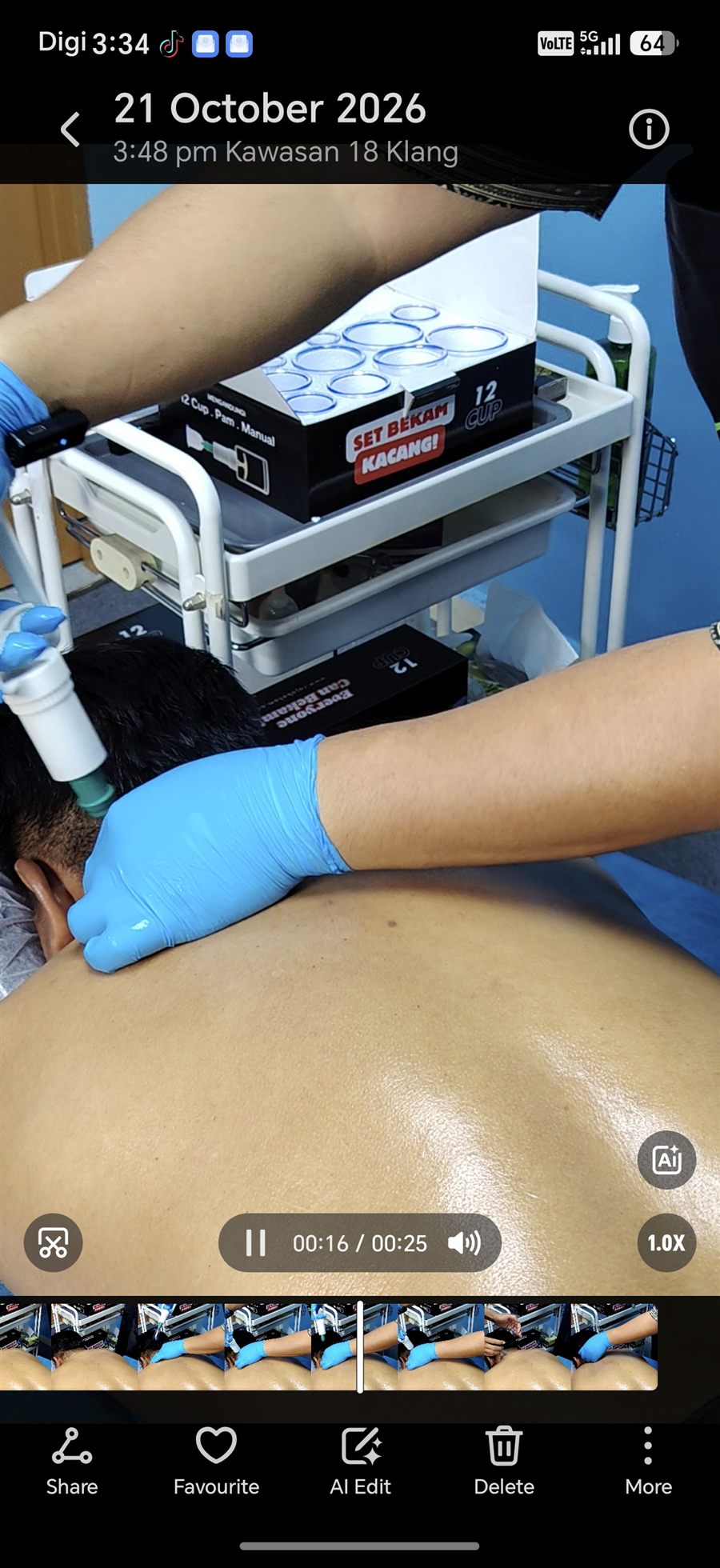 Set Bekam Kacang 12 Cup dan cawan rawatan di ruang rawatan